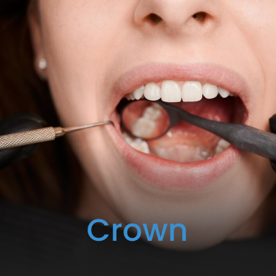Crown