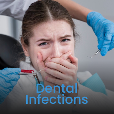 Dental Infections