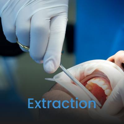 Extraction