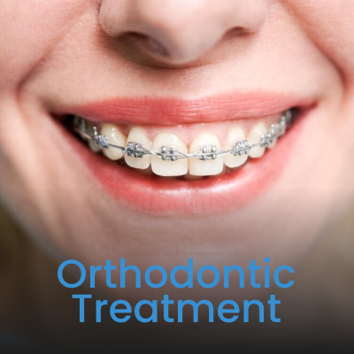 Orthodontic Treatment