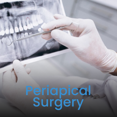 Periapical Surgery