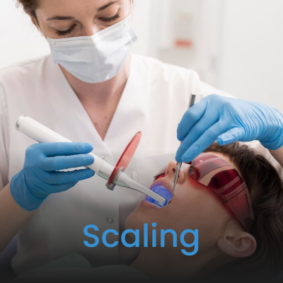 Scaling